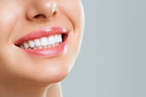 perfect healthy teeth smile young woman teeth whitening stomatology concept Blog
